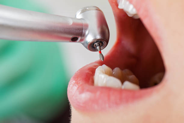 Best Cosmetic Emergency Dentistry in Hamilton, TX